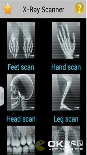 x射线扫描仪图1