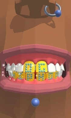洗牙图1