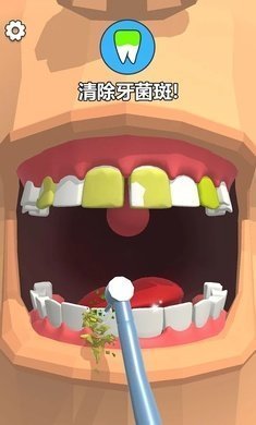 洗牙图3